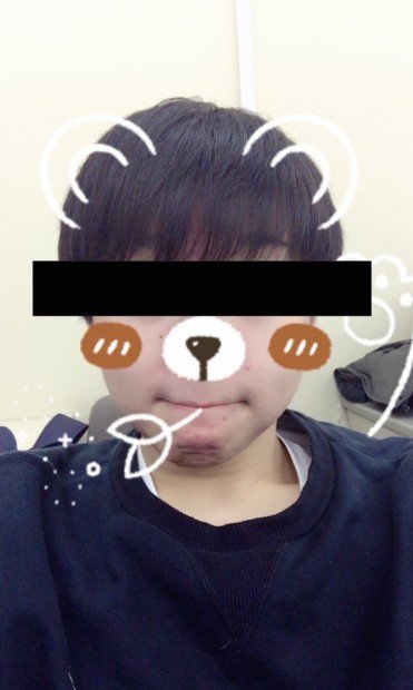 筆者・自撮りbefore