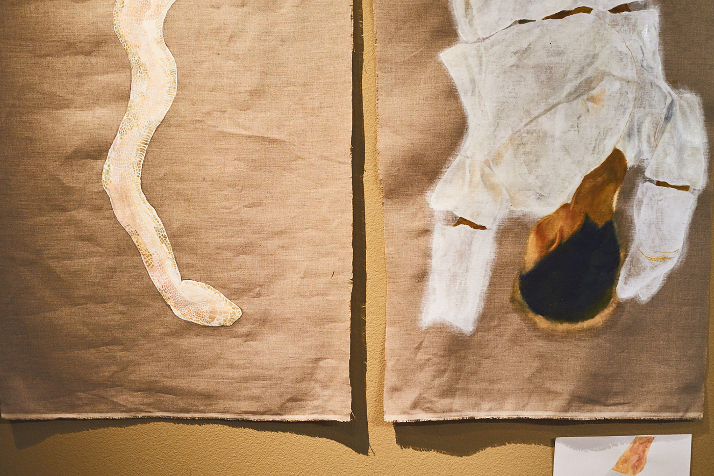 今井志芳夏さん『脱皮の夢』